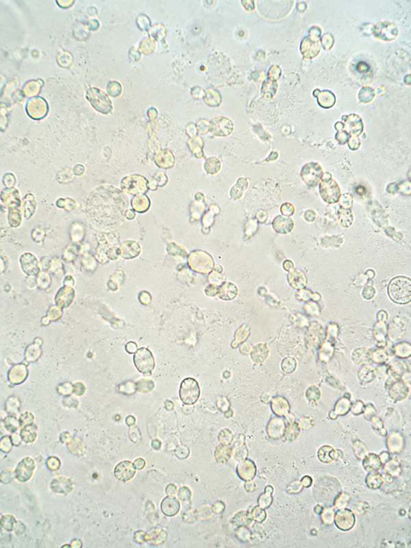 LactoSpore® Bacillus Coagulans